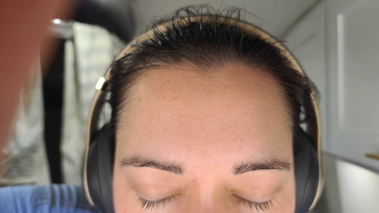 before-starting-differin-2