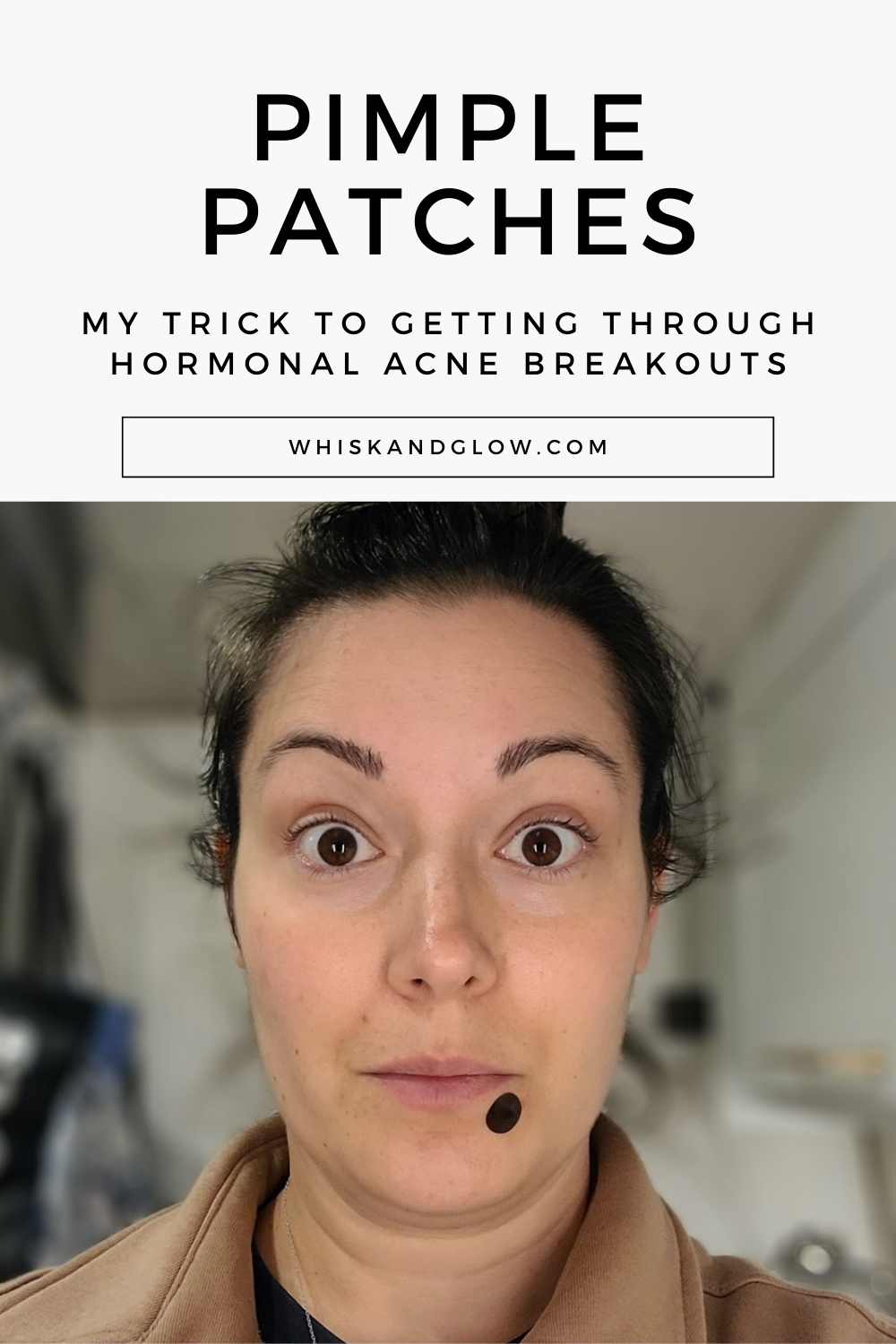 get-through-hormonal-acne