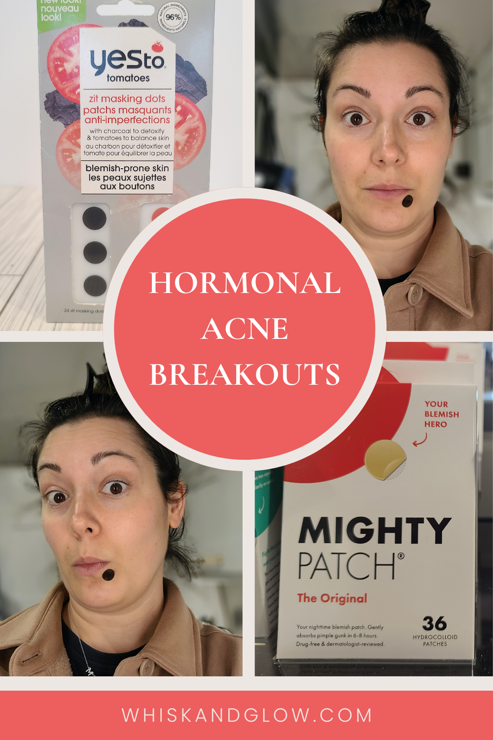 pimple-patches-acne-breakouts