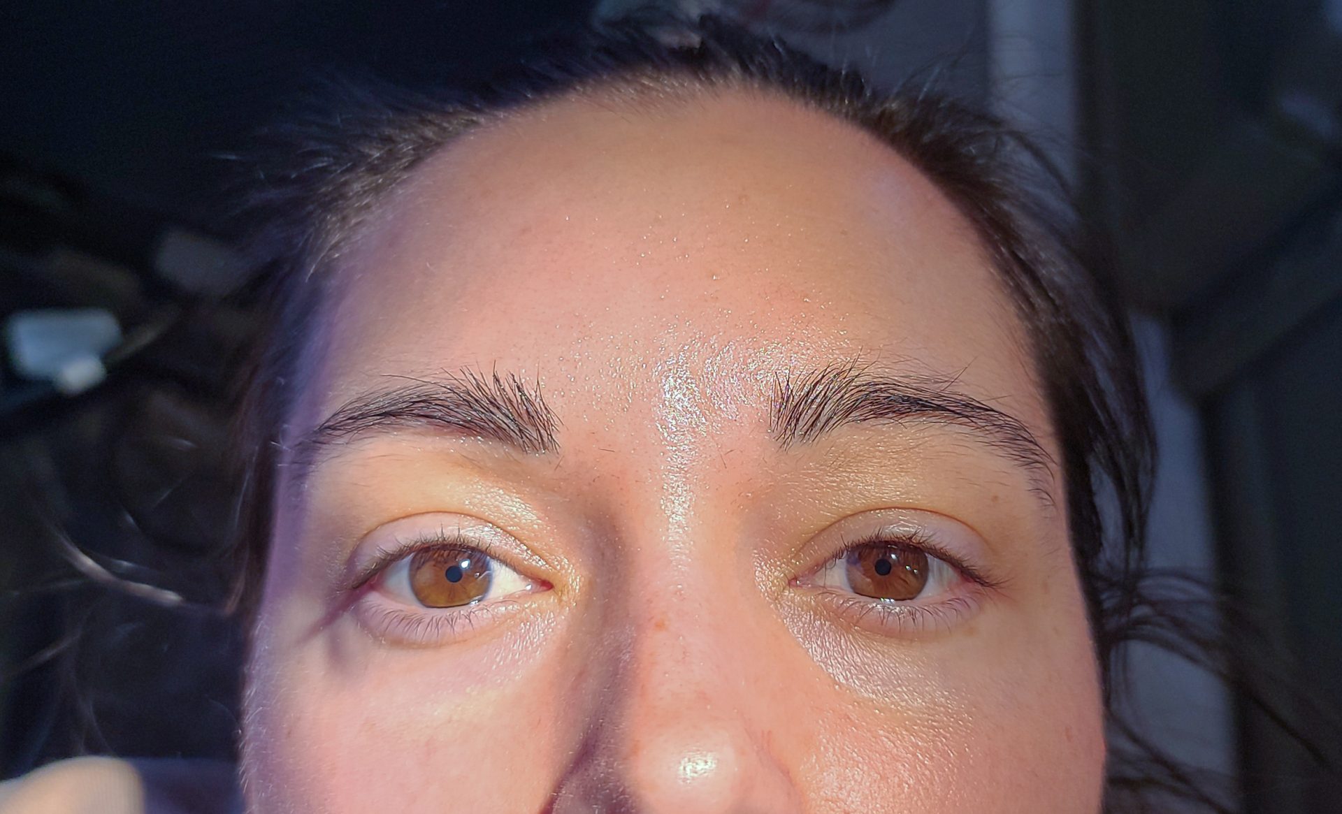 minoxidil-eyebrows-before-after