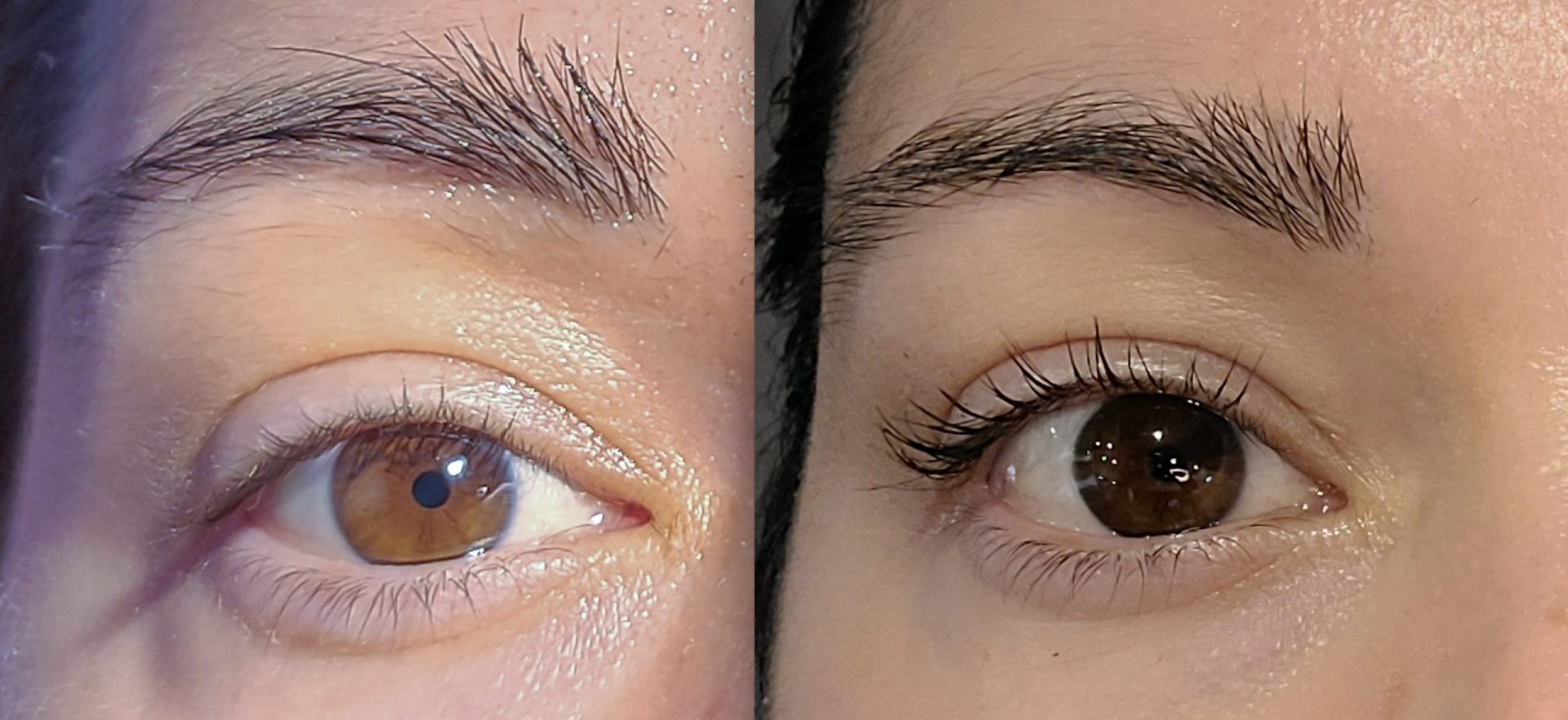 minoxidil-on-brows-before-after