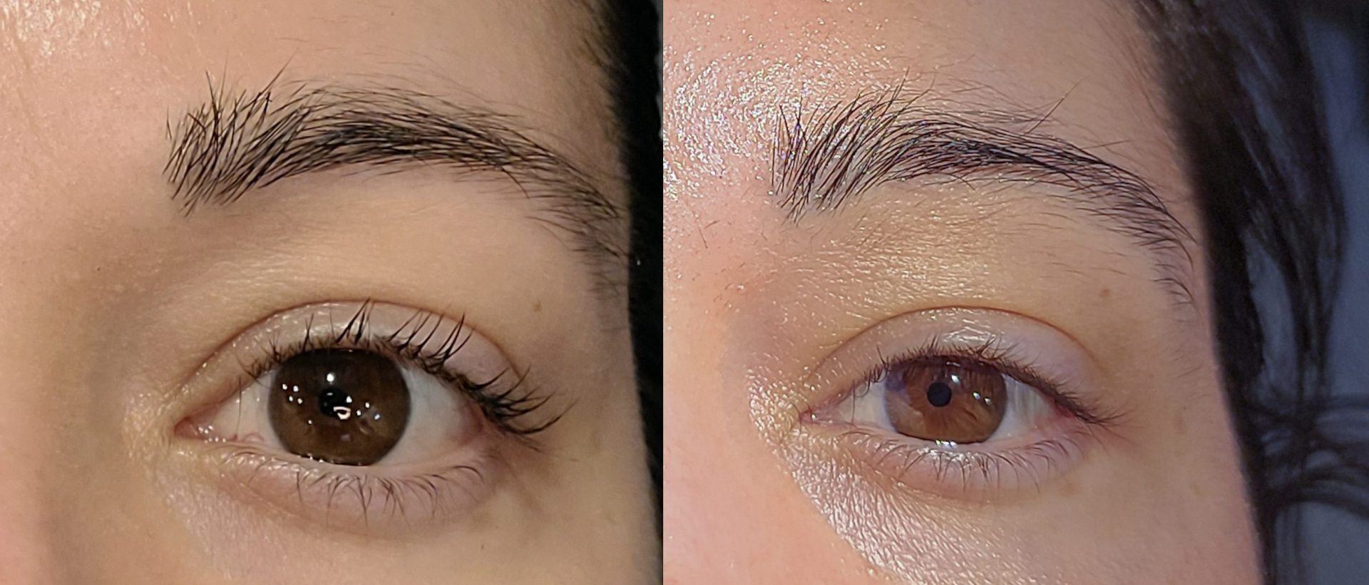 minoxidil-on-brows-before-after-comparison